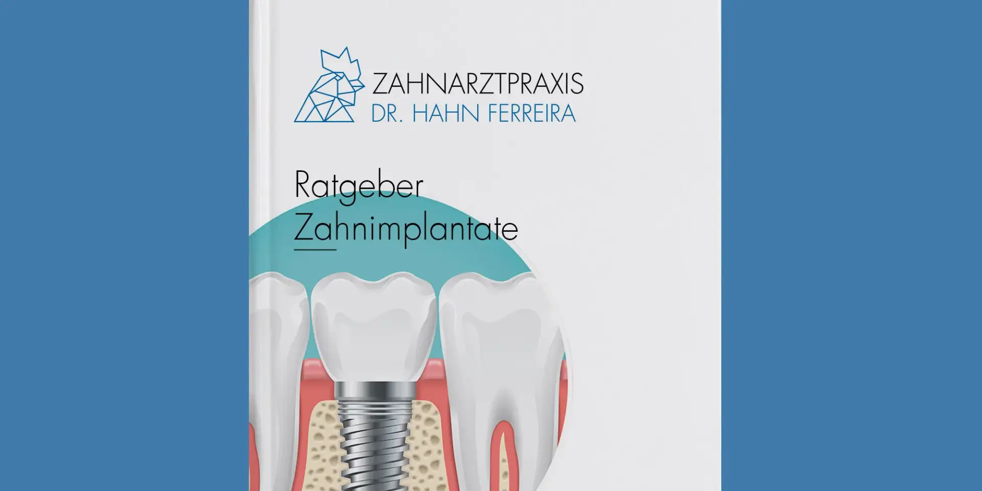 Patientenratgeber - Zahnarztpraxis Dr. Hahn Ferreira & ZÄ Radha - Saarbrücken